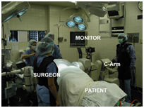 Lumbar Discectomy, Minimally Invasive Spine Surgery, Minimally Invasive Laminotomy India