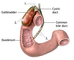Gall Bladder Removal Surgery India, Gallstones Symptoms India