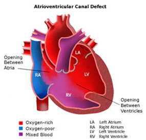 Pediatric Heart Surgery, Children Hospital, Cardiology