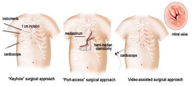 Pediatric Heart Surgery India, Children Hospital, Pediatric Hospitals, Heart