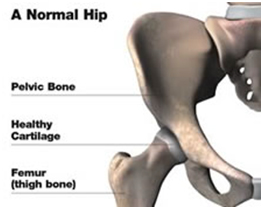 Hip Pain, Hip Pain Treatment, Hip Pain Causes, Hip Pain Diagnosis