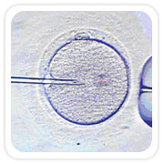 Testicular Sperm Extraction, TESE, Testicular Tissue, Intracytoplasmic Sperm Injection
