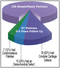 Mosaicplasty Surgery, Mosaicplasty, Surgery I India, Cost Of Mosaicplasty Surgery, Mosaicplasty Surgery Treatment Abroad