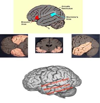 Temporal Lobectomy Surgery India Offers info on Epilepsy Temporal Lobectomy India, Results India, Surgery India