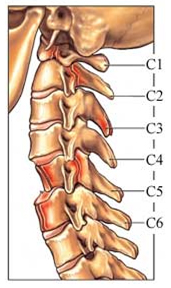 Neck Pain, India Cure For Neck Pain, Neck & Shoulder Pain Center, Neck Strain, Whiplash