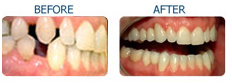 Dentistry India, Dental Surgeon India,India Dental Treatment