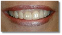 Laser Dentistry Treatment India, Laser Dentistry, Dental Laser Treatment, Laser Dental Clinic In India