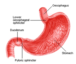 Stomach Cancer Treatment India offers info on Affordable Gastric - Duodenal Stomach Cancer Treatment India