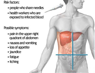 India Liver Cirrhosis Treatment Hospital India, Liver Cirrhosis India, Liver Cirrhosis Treatment India