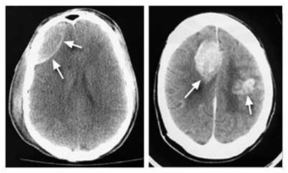 CT Scan offers info on CT  India, Computed Tomography  India, Computed Tomography CT  India, Body CT  India