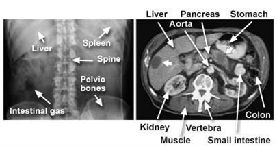 Computed Tomography  India, Computed Tomography CT  India, Body CT  India, CAT Scan  India, Medical Imaging  India