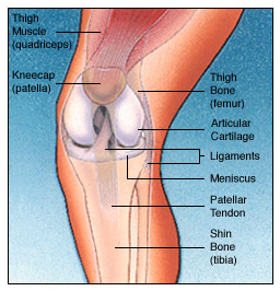 Total Knee Replacement Surgery India, TKR