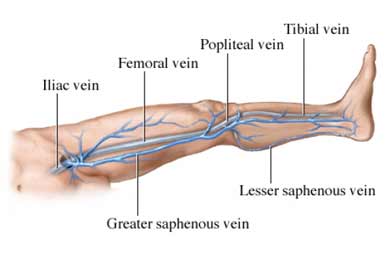 Leg Skin Vein Laser Surgery India offers info on Cost Leg Skin Veins Surgery India, Low Cost Leg Skin Veins Surgery Delhi India