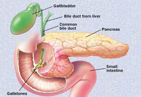 Gallstones Surgery India, Gallstone India, Gall Bladder Surgery India, Gallstone Remove India, Gallstone Removal Surgery India