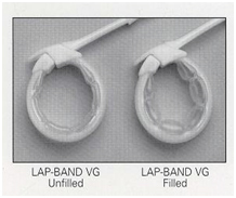 Laparoscopic Banding India, Risks Of Laparoscopic Banding Surgery India
