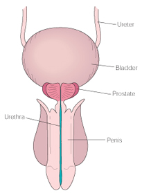 Transurethral Resection Prostate India Surgery offers info on Cost TURP Surgery Hospital India